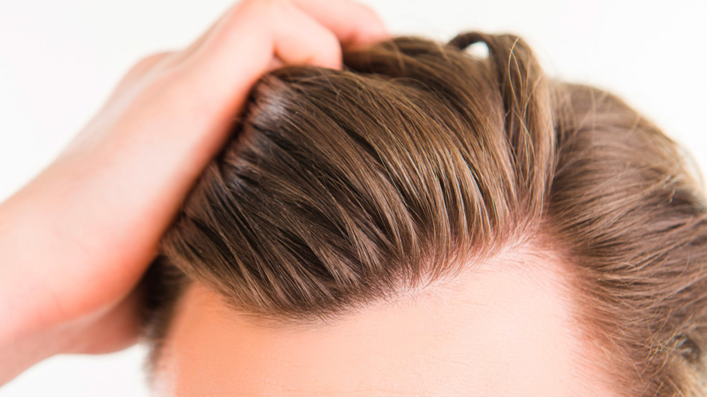 Photo de jolie cheveux d un homme - Greffe de cheveux a Paris | Dr Marwen Youssef Paris